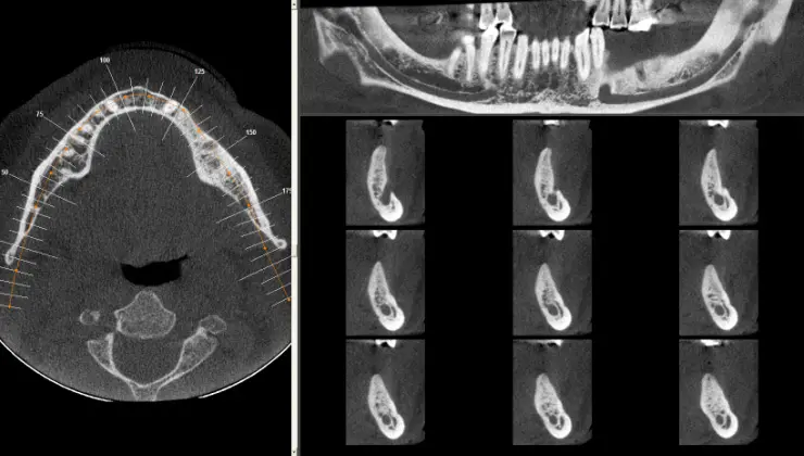 iCat Dental Xray Midlothian VA | Virginia Oral Surgeons | Commonwealth Oral & Facial Surgery