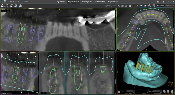 iCat Dental Xray Midlothian VA | Virginia Oral Surgeons | Commonwealth Oral & Facial Surgery