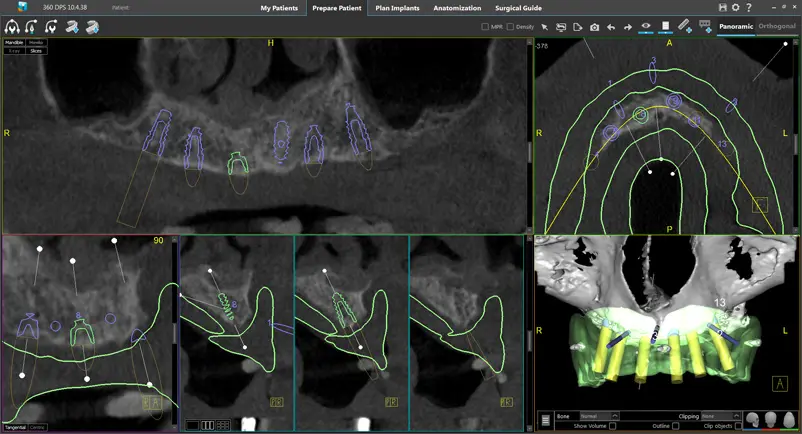 iCat Dental Xray Richmond VA | Virginia Oral Surgeons | Commonwealth Oral & Facial Surgery