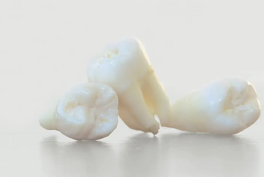 wisdom teeth Henrico