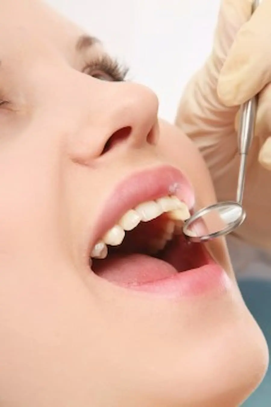 bone grafting Richmond