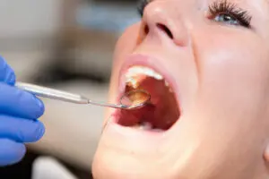 chester tooth extraction