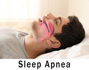 richmond sleep apnea