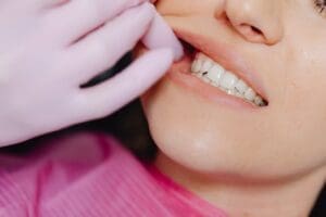 Photo by Photo By: Kaboompics.com: https://www.pexels.com/photo/a-person-wearing-latex-gloves-checking-a-woman-s-teeth-6627526/ - yount adult oral exam